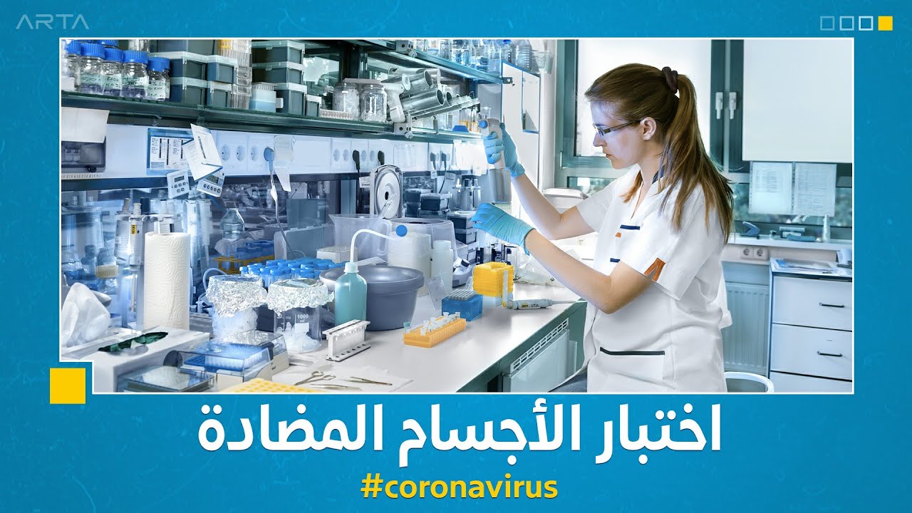 اختبار الأجسام المضادة