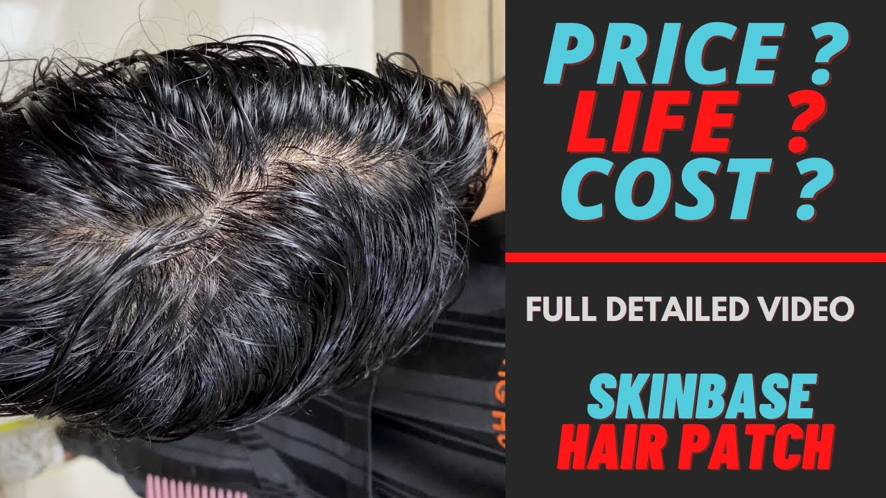 Price of Skin Base Hair Patch ? | Full Detailed Video | Premium Hair Replacement System | 9953384242