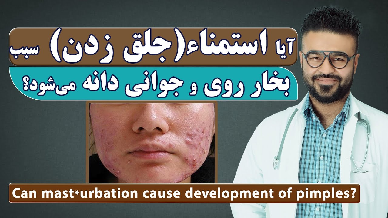 آیا خودارضـ/ـایی سبب بخار/جُوش و جوانی دانه در چهره می شود؟| داکتر قیس نیکزاد