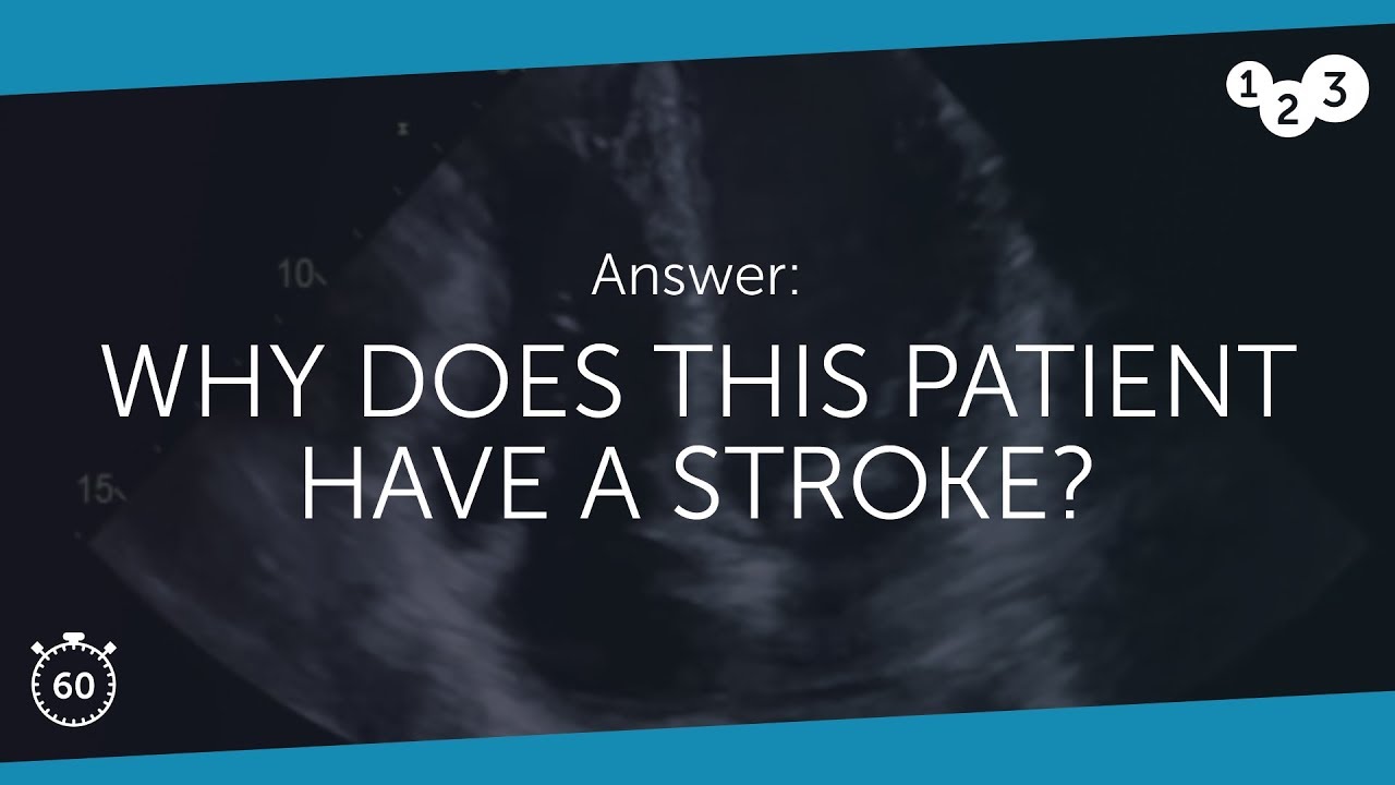 60 Seconds of Echo Teaching Answer: Why did this patient have a stroke?