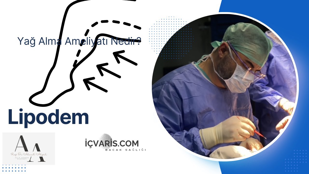 Lipödem, Lenfödem ve Yağ Aldırma | Vaser Liposuction – Prof. Dr. Ahmet Akgül
