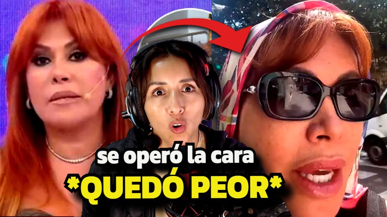 Magaly APARECE luego de OPERACIÓN y se BURLAN en REDES SOCIALES