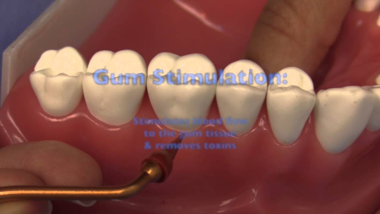 Home Care and Hygiene Recommendations for Dental Implants