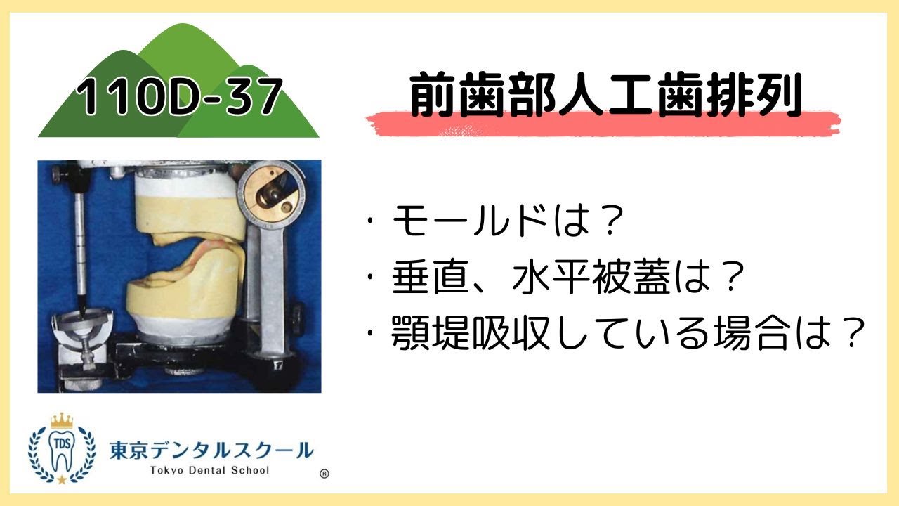 前歯部人工歯配列の垂直・水平被蓋　歯科医師国家試験対策を解く！