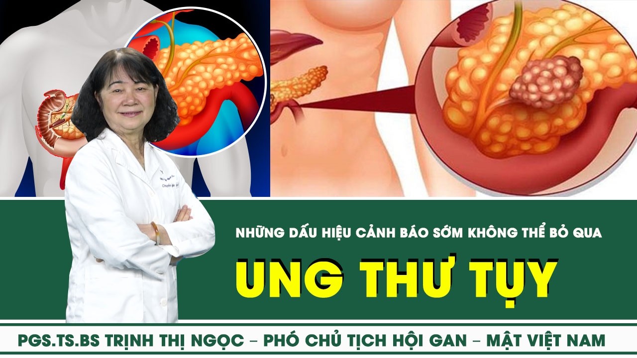 [LIVE] Ung thư tụy: những dấu hiệu cảnh báo sớm không thể bỏ qua | SKĐS