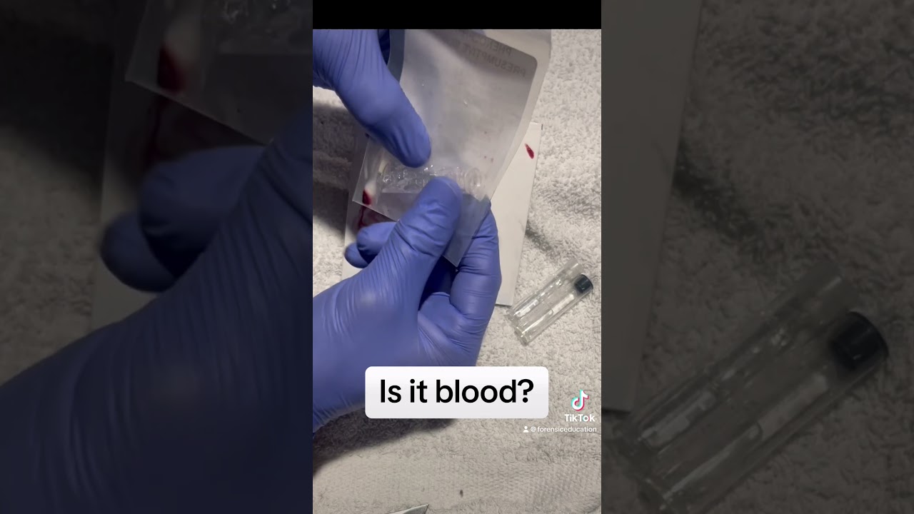 Detectar sangre en la escena de un crimen con fenolftale&iacute;na #csi #adn #forense #mancha de sangre