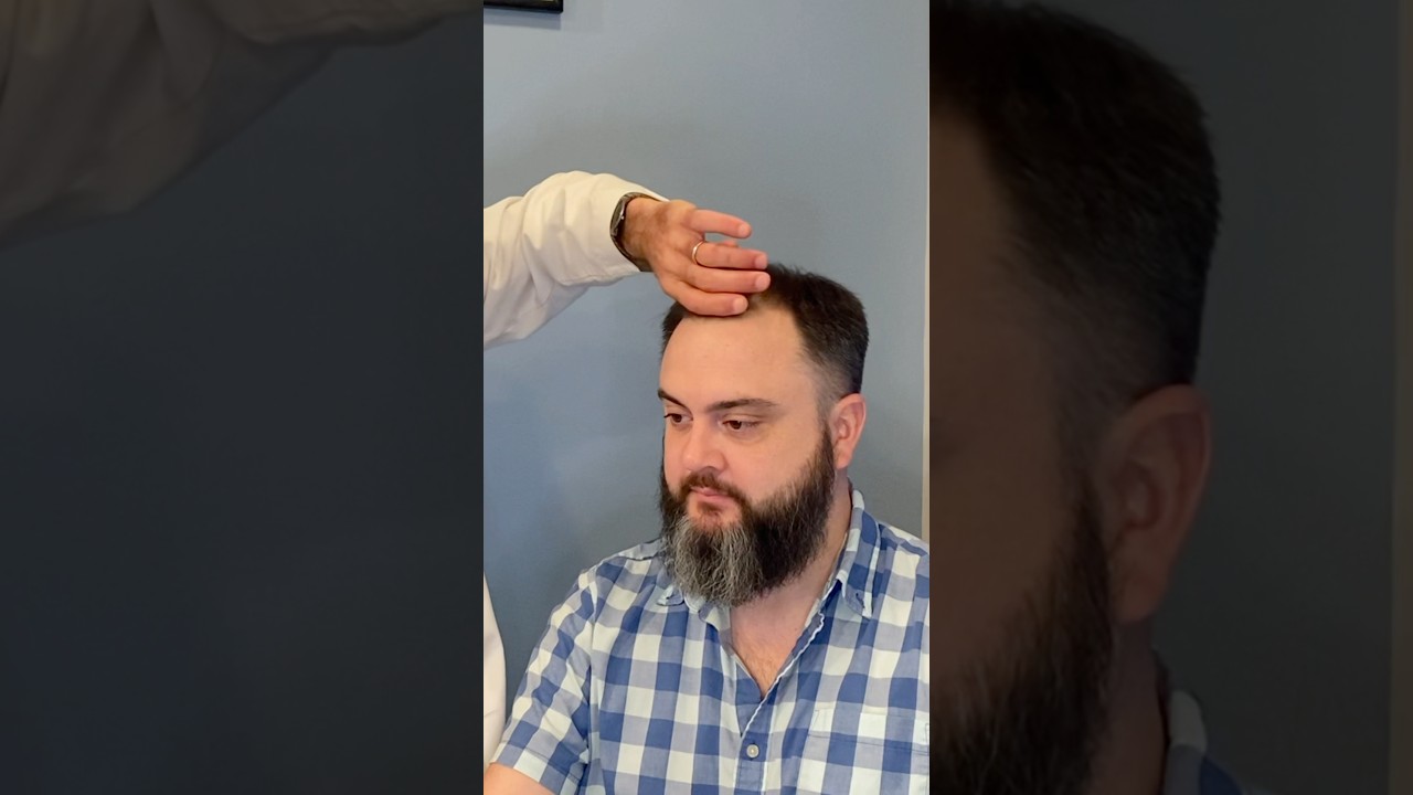 How Many Hair Follicles Should You Get Transplanted?