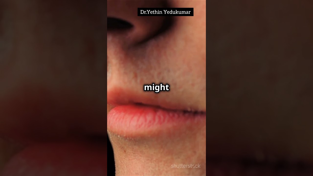 Vestibulitis of Nose. #nasalhealth #entdoctor #healthtips #entcare