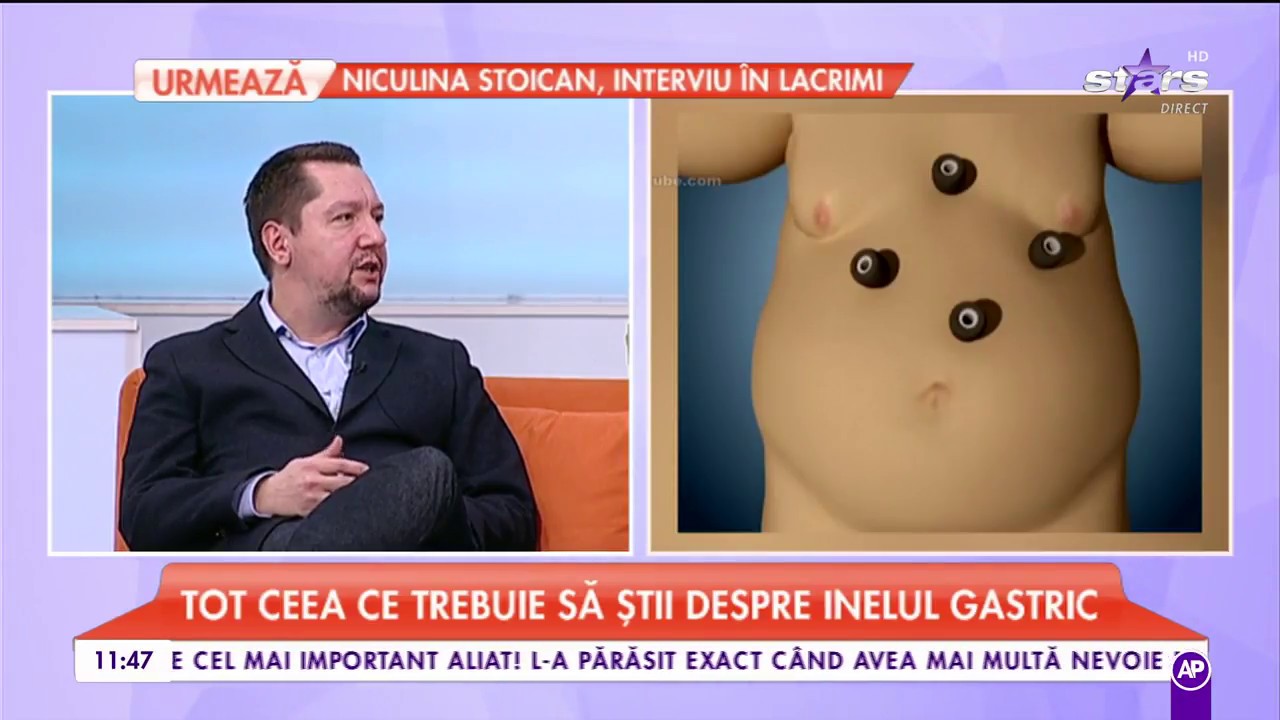 Tot ce trebuie să știi despre balonul și inelul gastric. Beneficiile și riscurile intervenției