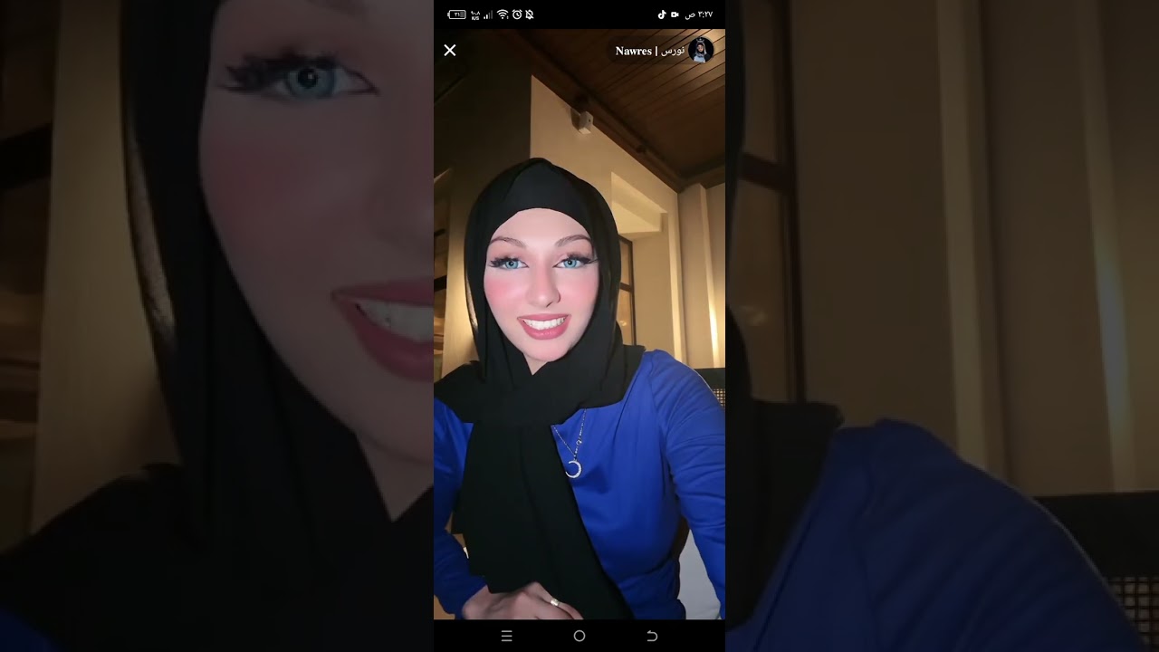 بث مباشر اليوم نورس مشاهده ممتعه للجميع الجزء الثاني و الاخير