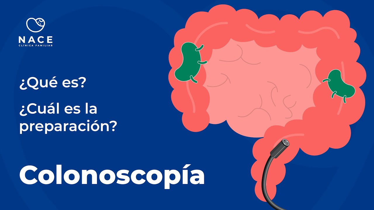 COLONOSCOPÍA - CLÍNICA NACE