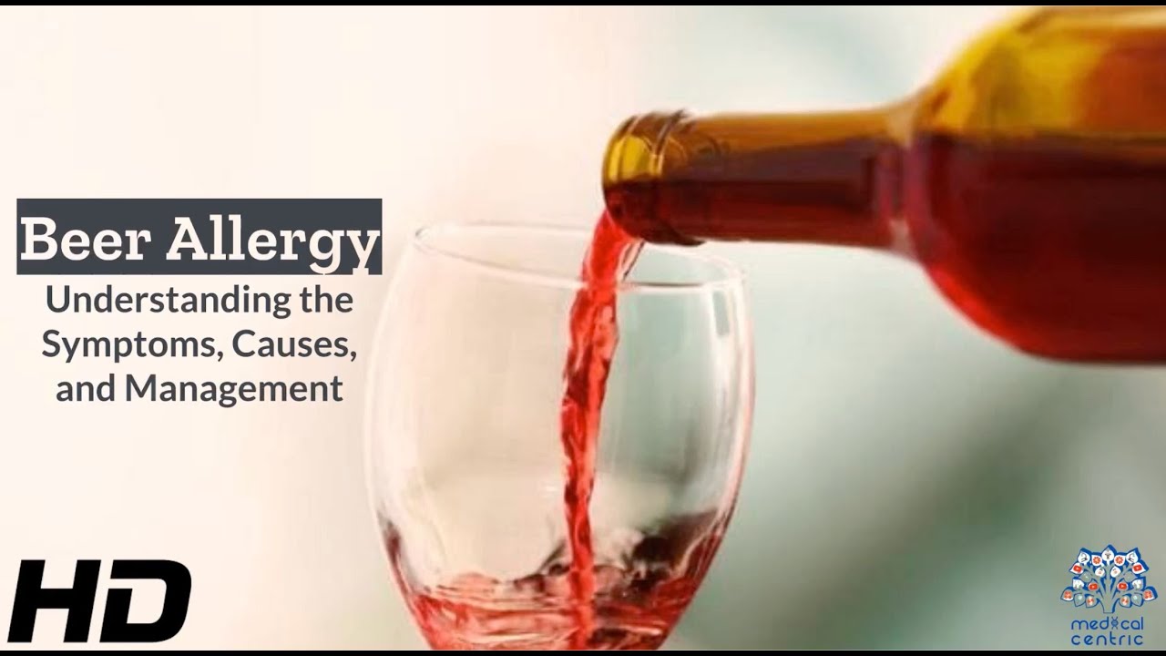 Beer Allergy Explained: Symptoms, Triggers & Treatment Options