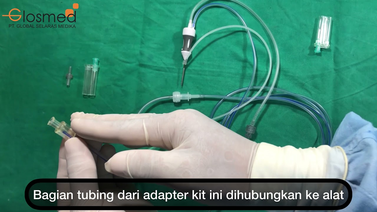 Bausch+Lomb Stellaris Anterior - Set Up Vitrectomy Anterior