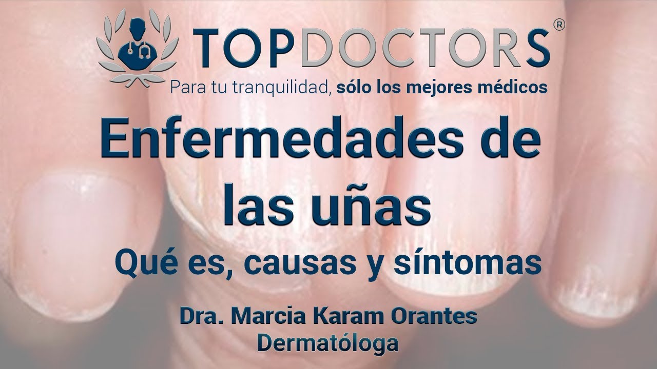 &iquest;C&oacute;mo tratar las enfermedades de las u&ntilde;as? Conoce todos los detalles
