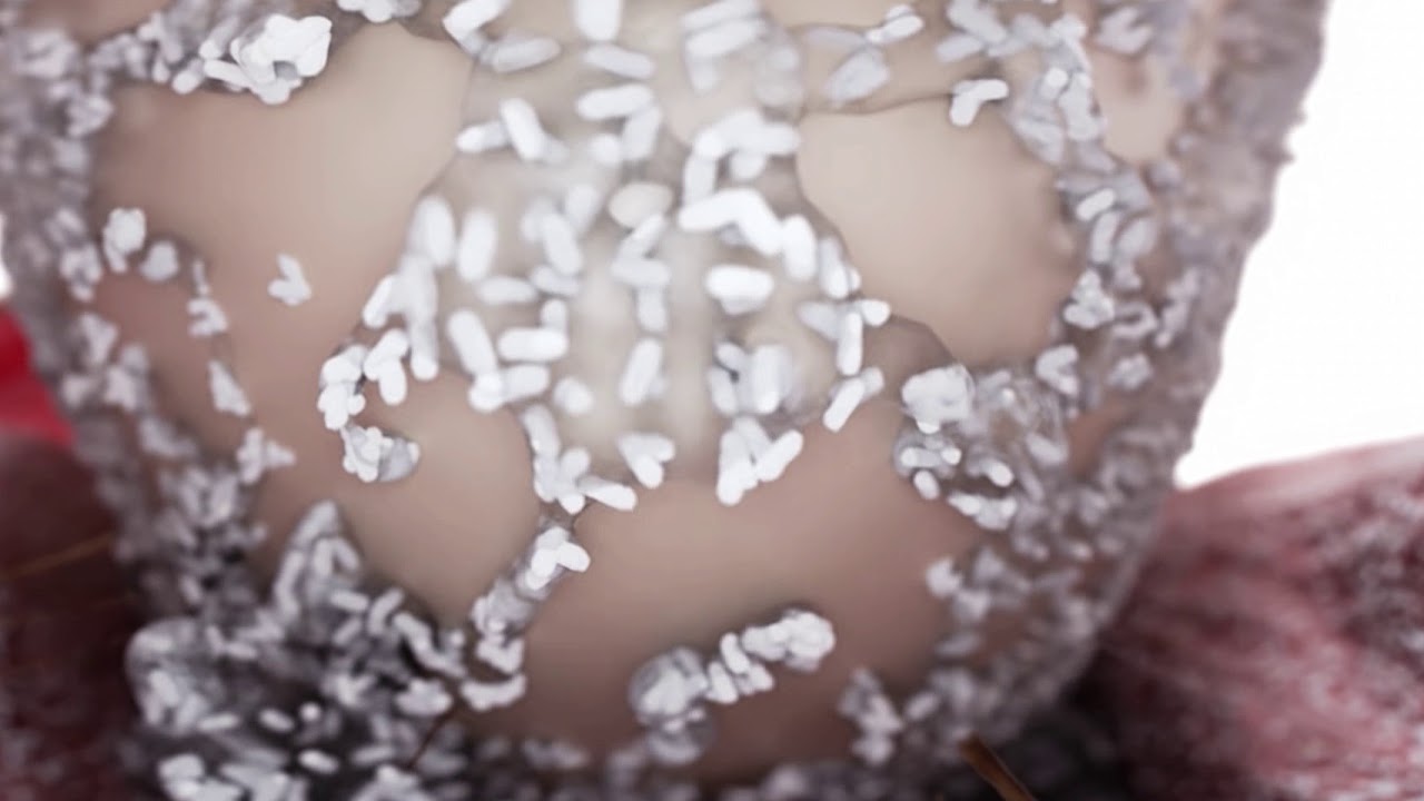 The Perio Link, gum disease and diabetes connection.