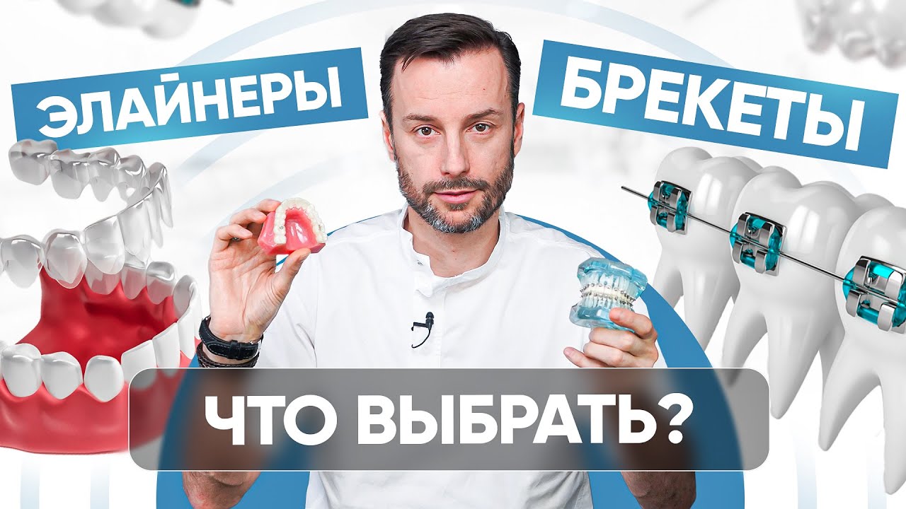 Элайнеры и Брекеты - в чем разница? Что выбрать?