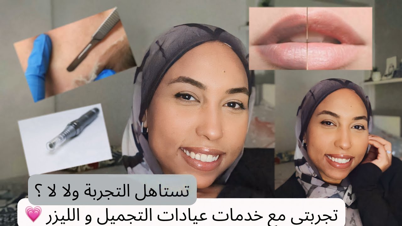 تجربتي مع عيادات التجميل 💆🏽‍♀️ايه يستاهل وايه لا