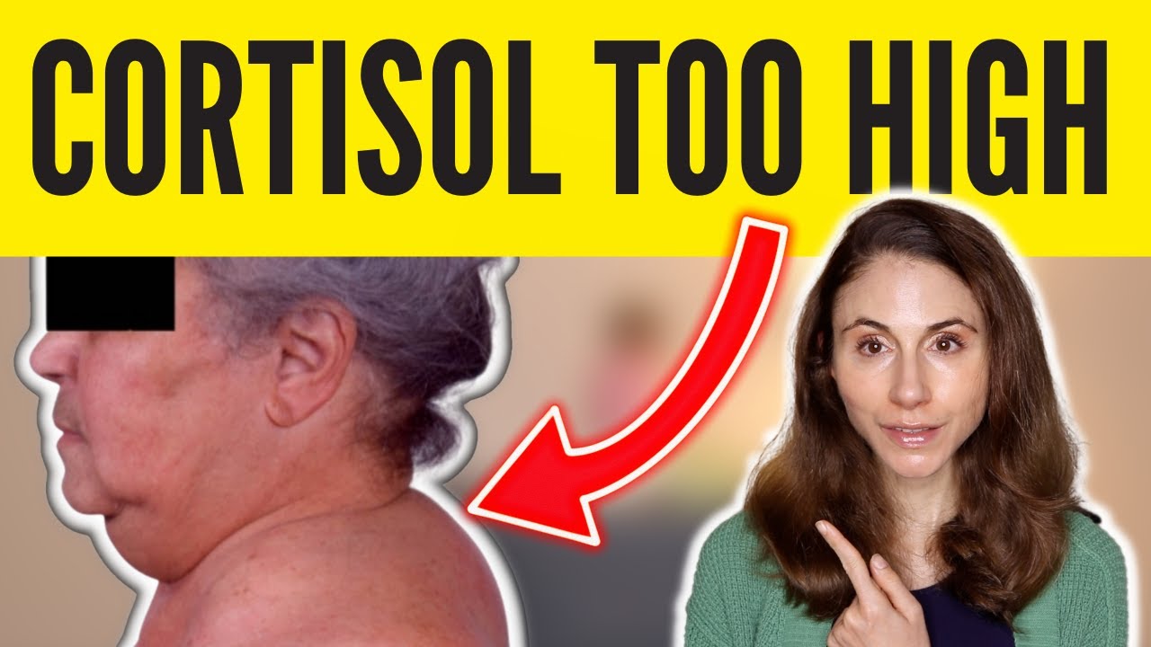 8 SIGNS OF HIGH CORTISOL *SKIN & HAIR* @Dr Dray