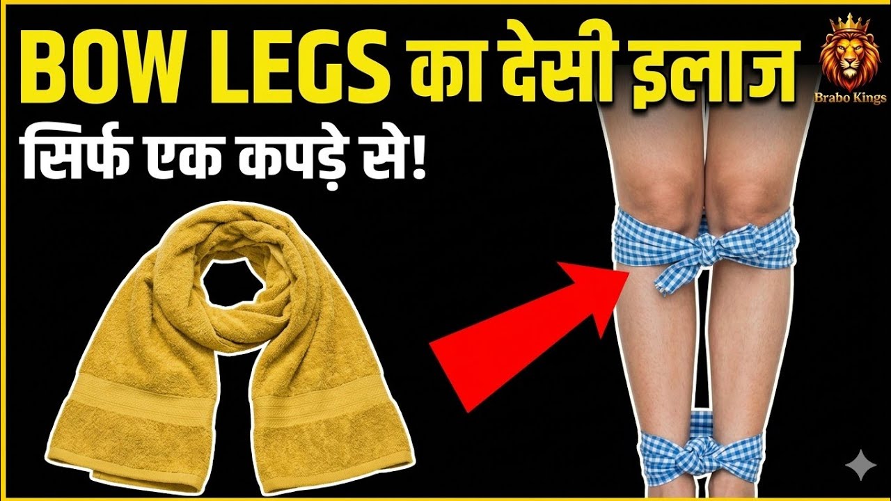 Bow leg ka dysi jugaad||bow leg ko kaisy thik kary||bow leg gamchi