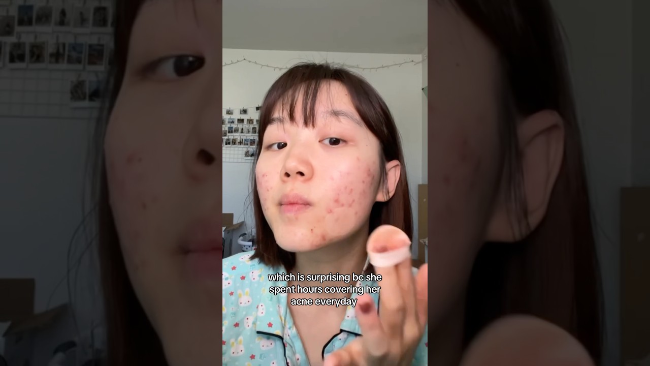 It&rsquo;s not about never covering up, it&rsquo;s about not hiding anymore 🙂&zwj;↕️🫶 #acne #makeup #clearskin
