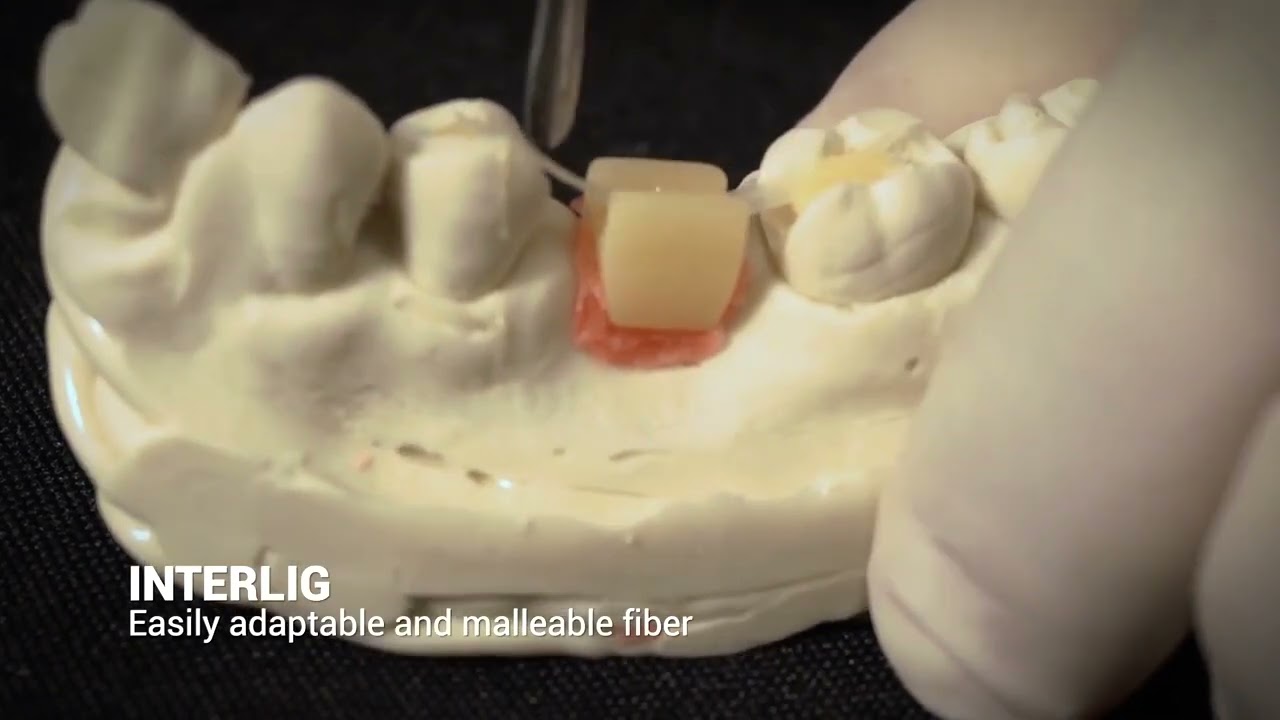 INTERLIG-Adhesive Prosthesis #INTERLIG-Adhesive Prosthesis#Angelus#BintangSaudaraDental