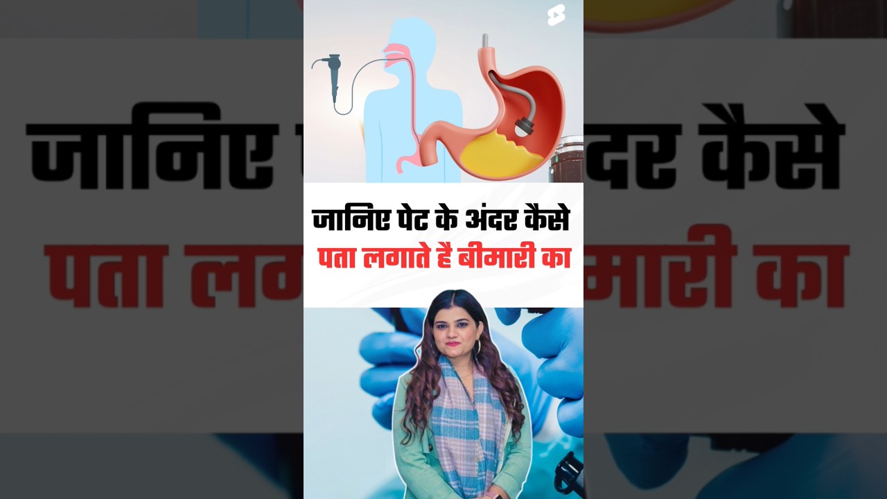 जानिए कैसे जांच होती है पेट के अंदर किसी बीमारी की by endoscopy|| Kajal mam #endoscopy #shorts
