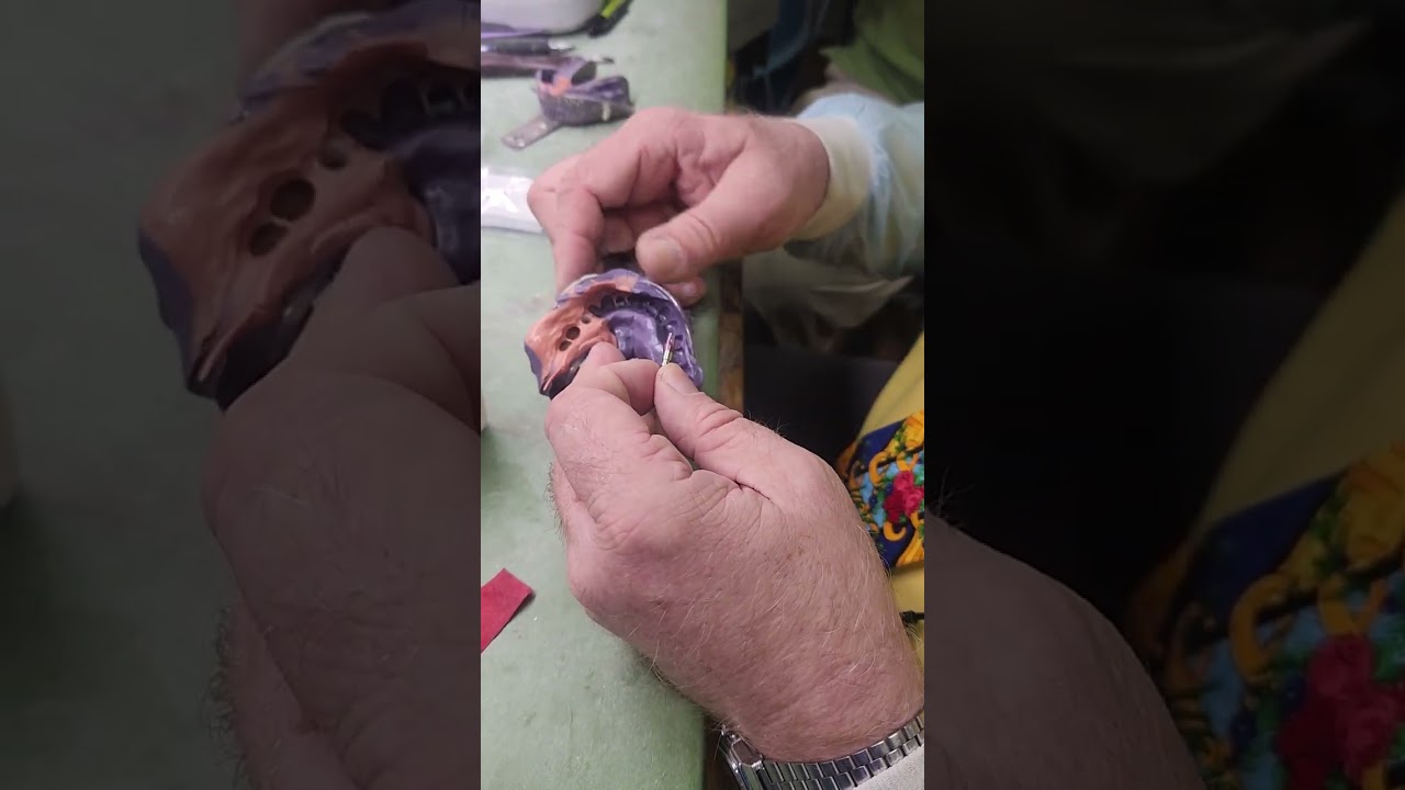 seating implant abutment on the analog in an impression
