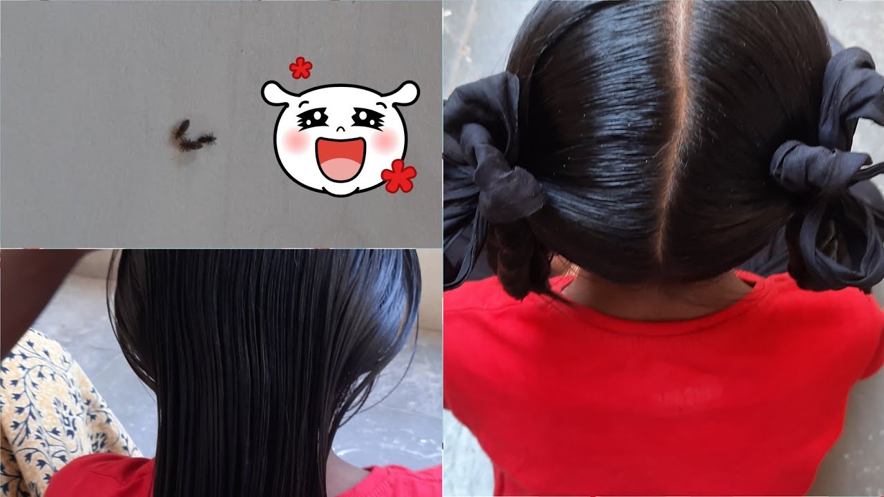 heavy oil & lice combing||lice picking on my friend daughter short hair||hair style double folding |