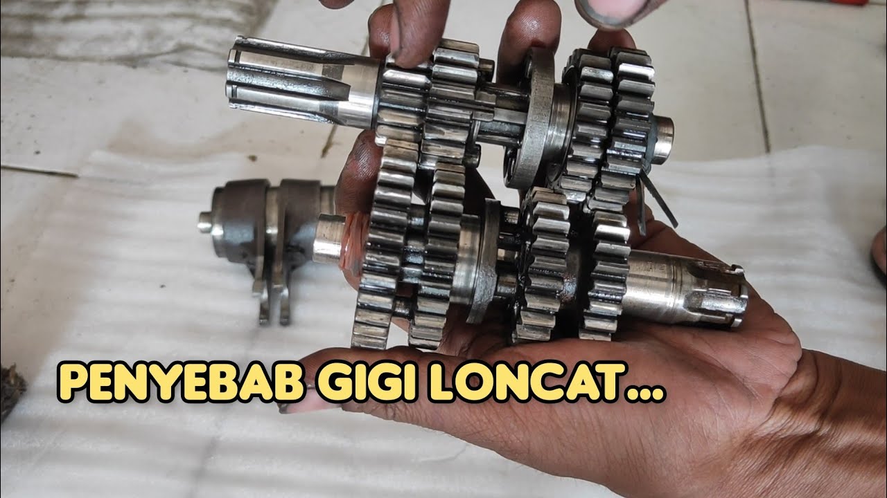 Penyebab gigi presnel 2-3 loncat