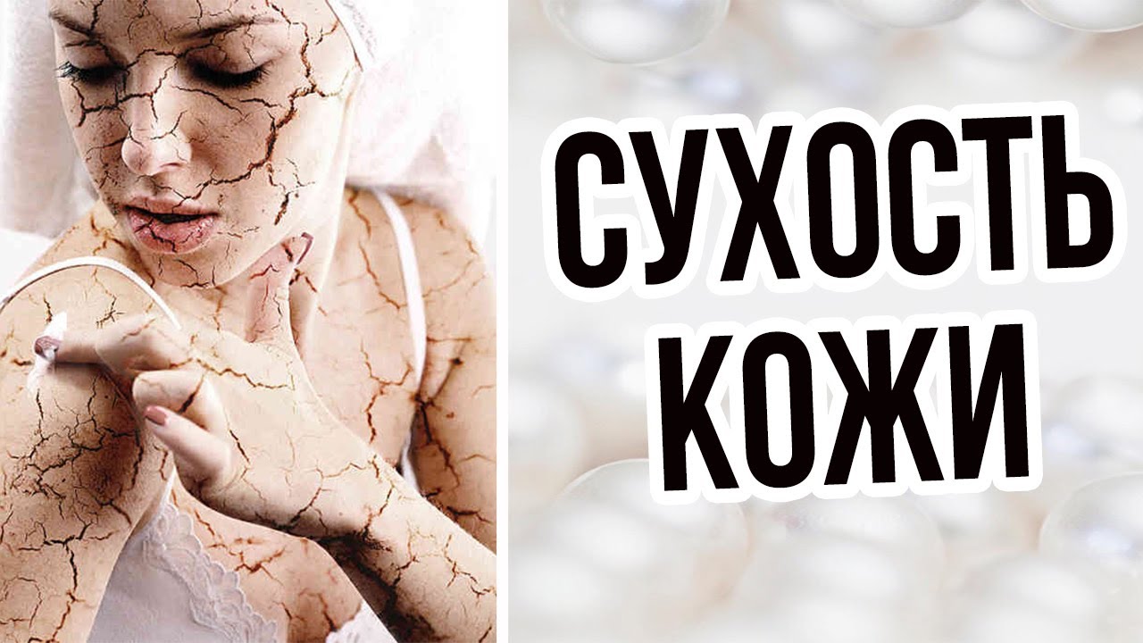СУХОСТЬ КОЖИ РУК И ТЕЛА / НАРУШЕНИЕ МИКРОЦИРКУЛЯЦИИ И СУХОСТЬ КОЖИ / СОВЕТЫ ВРАЧА