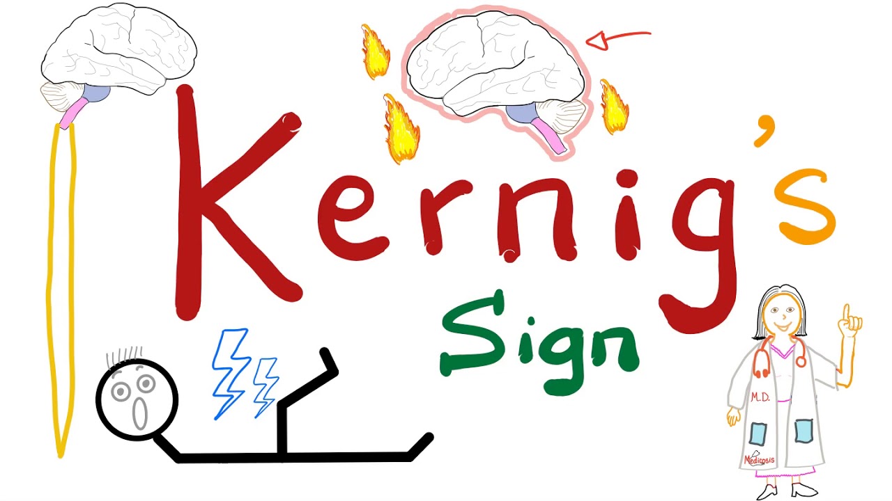 Kernig Sign | Meningitis | Neurology Physical Exam