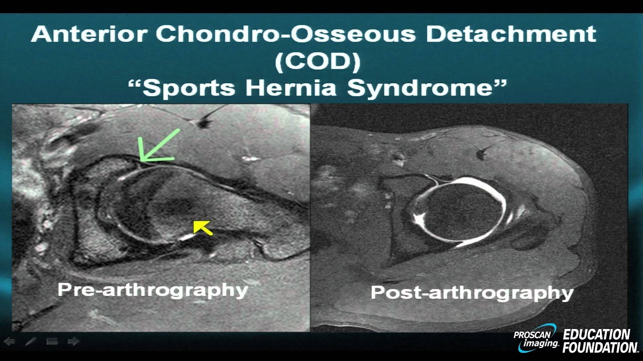 MRI Online: Hip Pathology, Part II