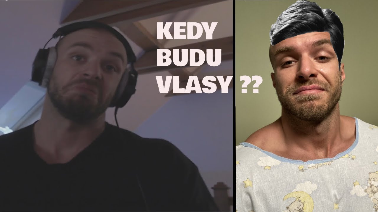 RESTT kedy bude transplantácia vlasov ???