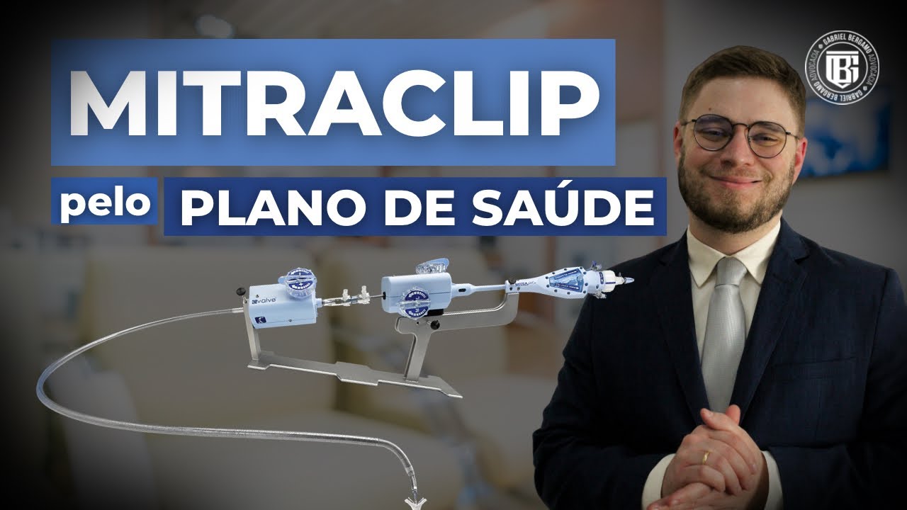 MitraClip pelo Plano de Saúde: Saiba Como Garantir | Gabriel Bergamo