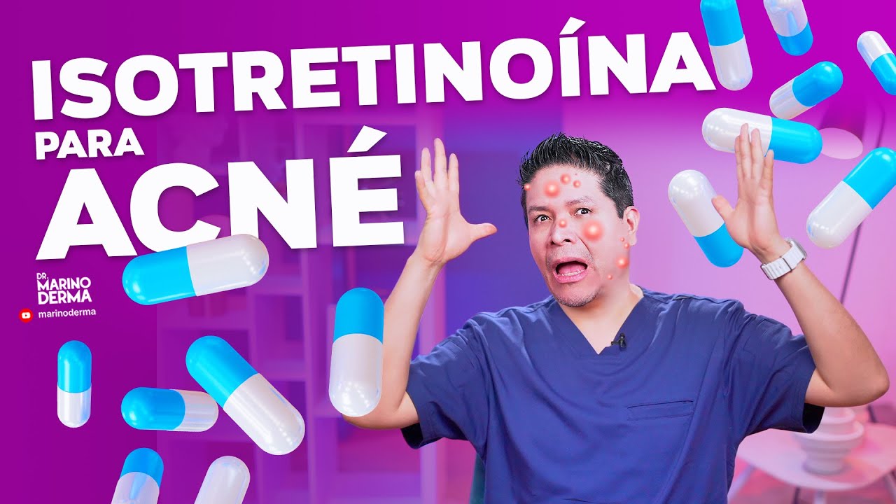 ISOTRETINOÍNA PARA ACNÉ || DERMATÓLOGO OPINA