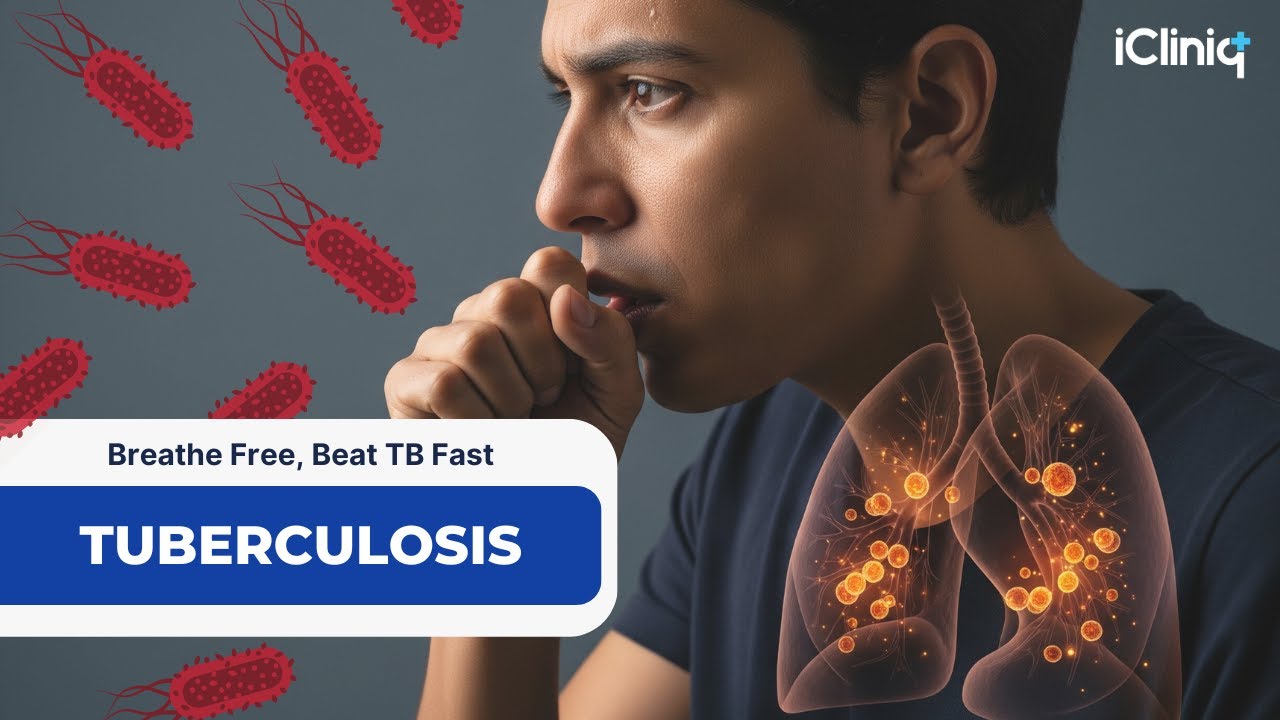 Tuberculosis Is Back in the U.S. - What You Need to Know in 2025 | iCliniq