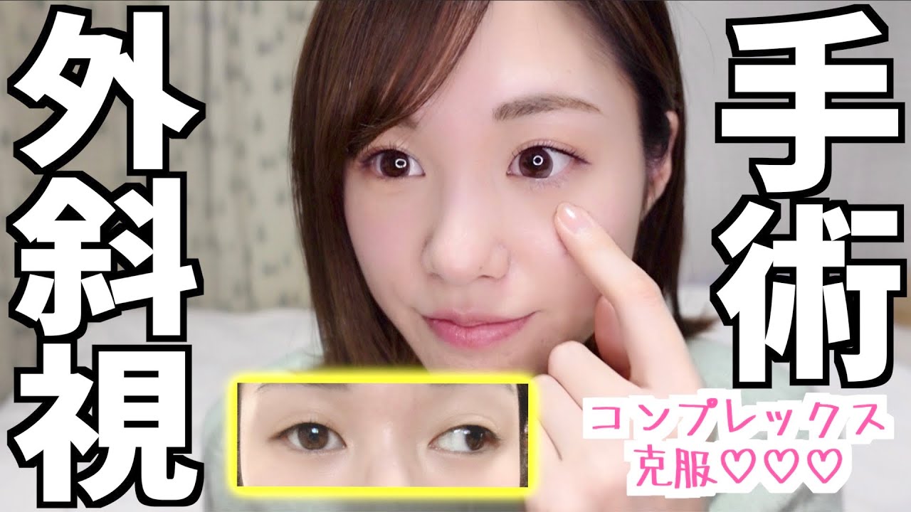 斜視の手術をする事になりました！【コンプレックス】