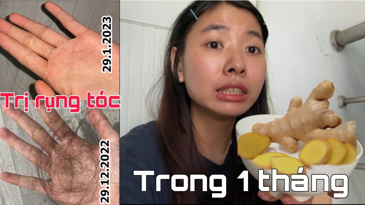 Trị Rụng Tóc Trong Vòng 1 Tháng Và Kết Quả l Ủ tóc với gừng tại nhà l Hair Care Tips With Mingan