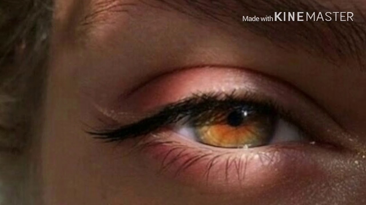 Bye bye eye melanin*CAUTION POWERFULLL*