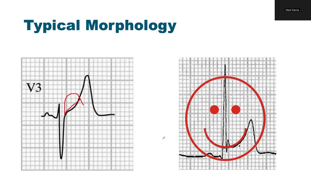 ECG accreditation Part 1