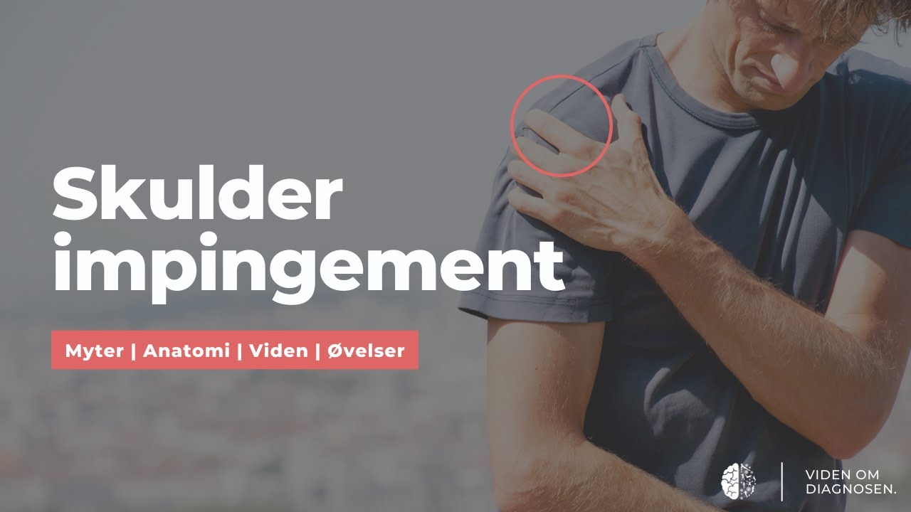 Skulder Impingement: Bliv smertefri uden operation (Myter | Anatomi | Viden | Øvelser)