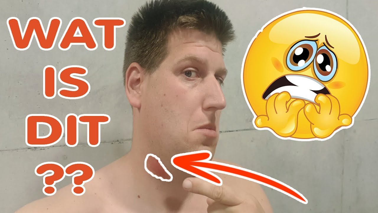 VREEMDE KNOBBEL IN MIJN NEK!! KOETLIFE VLOG