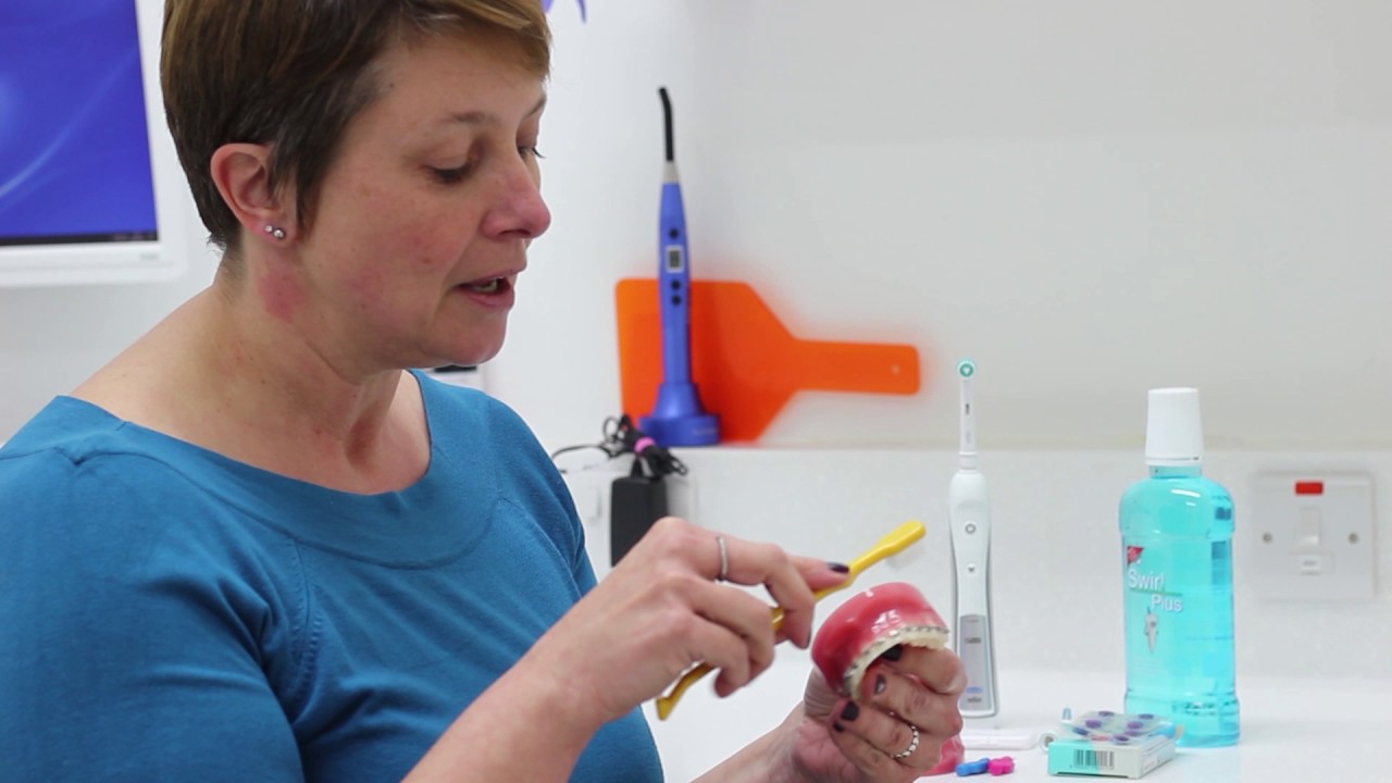 Braces Treatment aftercare