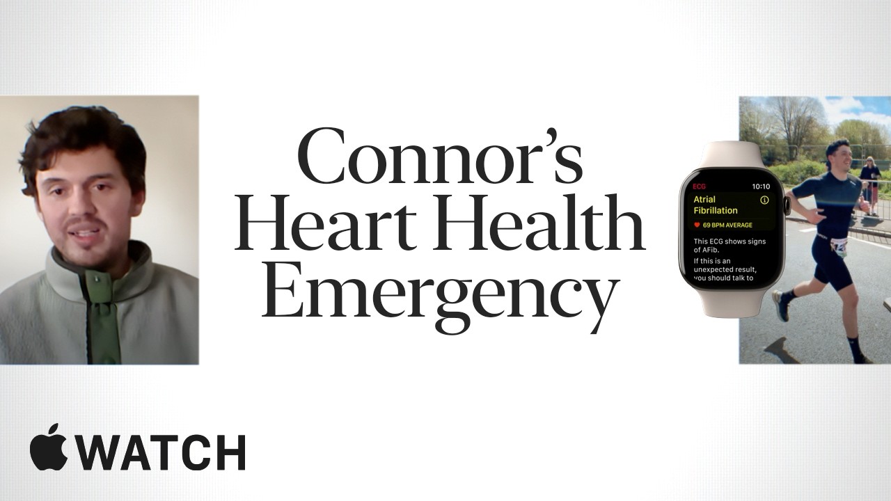 Apple Watch ECG: Connor&rsquo;s True Apple Watch Story
