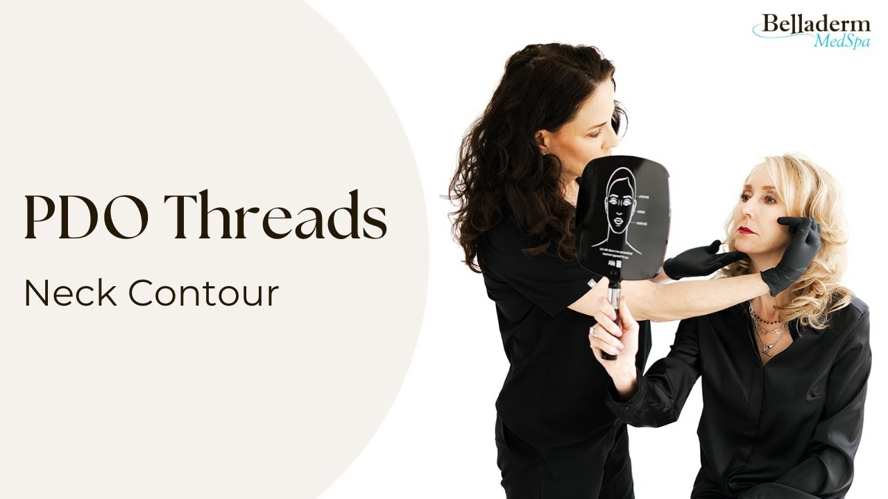 PDO Threads: Neck Lift - Belladerm MedSpa