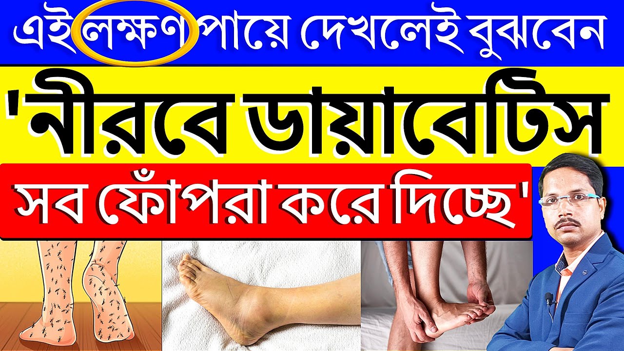 এই সংকেত পায়ে দেখলেই বুঝবেন Diabetes আপনাকে শেষ করে দিচ্ছে⚠️ডায়াবেটিস থেকে চিরতরে মুক্তির উপায় |