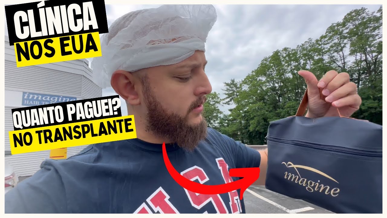 CLÍNICA NOS EUA PARA TRANSPLANTE CAPILAR - BARATO DEMAIS