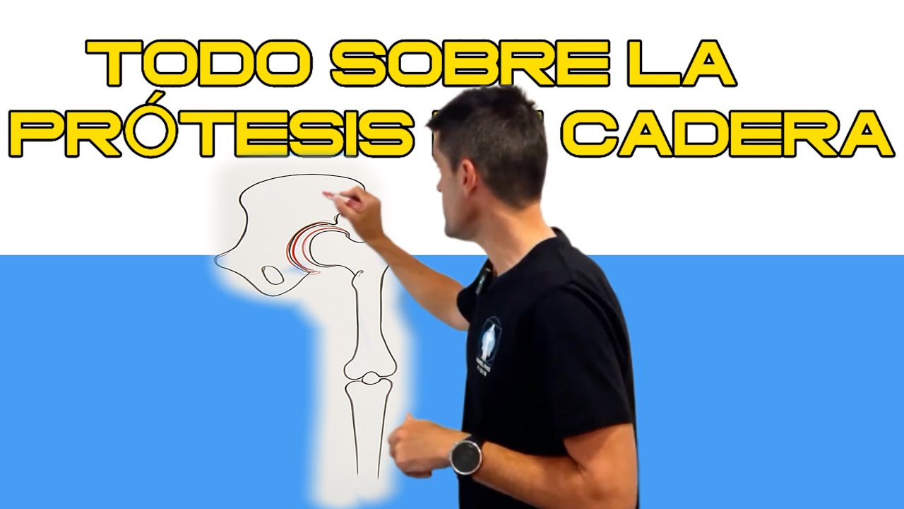 Prótesis de cadera explicada fácil: riesgos, cuidados y consejos