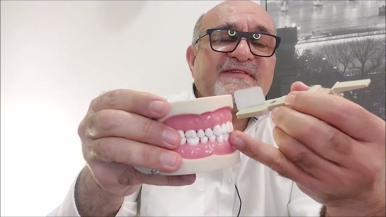 Snap A Ray Sensor Holder for the Upper Posterior Teeth