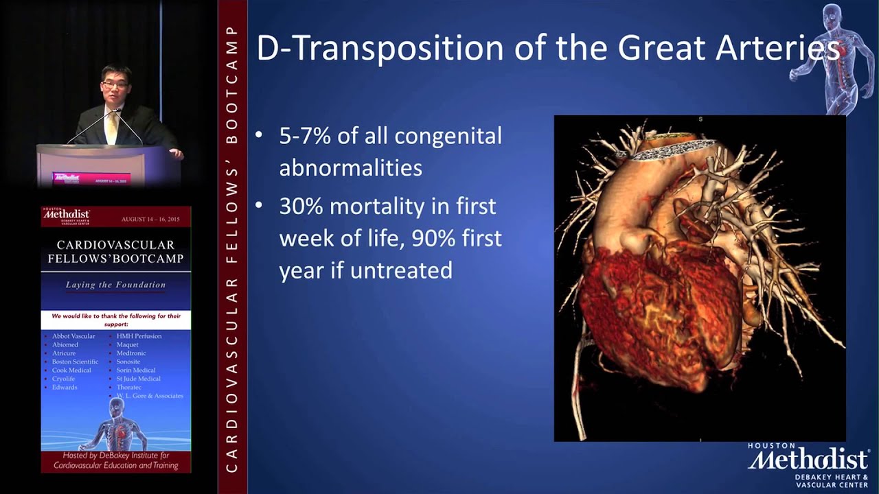 Adult Congenital 101 (C. Huie Lin, MD, PhD)